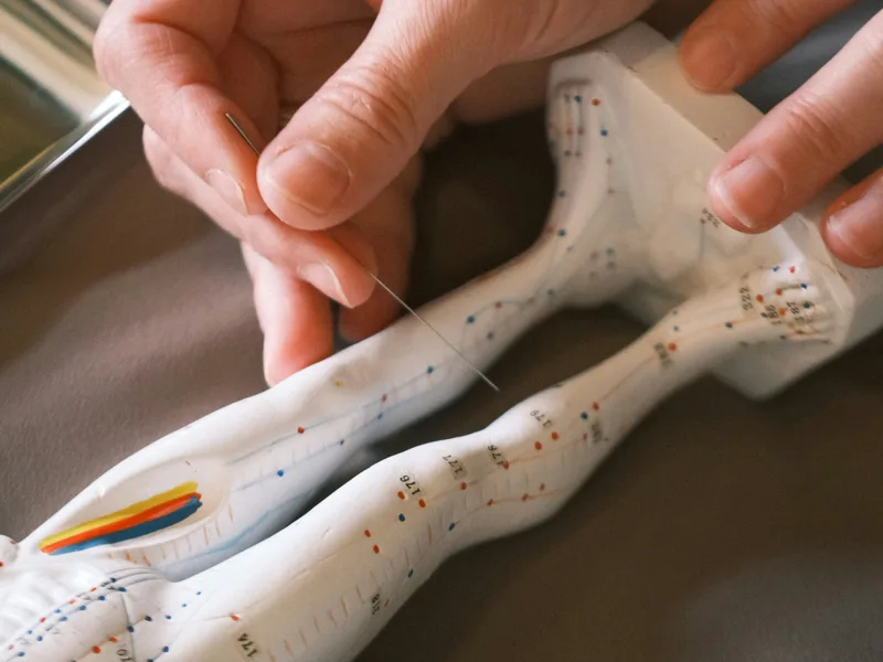 Acupuncture at New Beginnings Chiropractic in Hudsonville