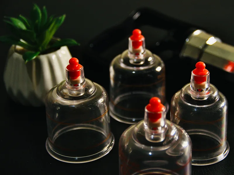 How Cupping Therapy works at New Beginnings Chiropractic