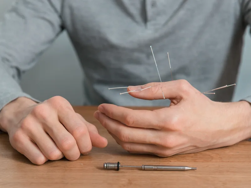 Dry Needling at New Beginnings Chiropractic in Hudsonville