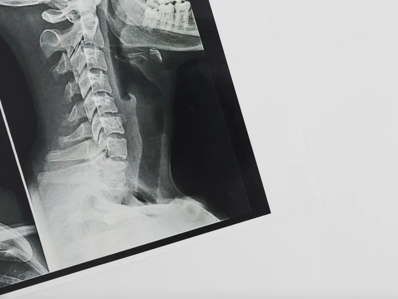 X-Rays at New Beginnings Chiropractic in Hudsonville